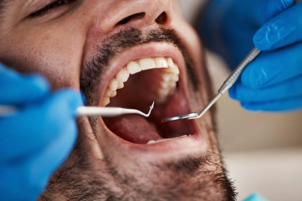 Best Urgent Dental Care for Toothaches in Inverness Highlands South, FL